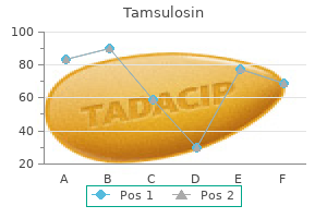 order discount tamsulosin line